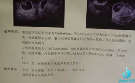 得荣县哪里有招代妈的,武汉试管婴儿专家告诉你移植单胎和双胎哪个好-想要孩