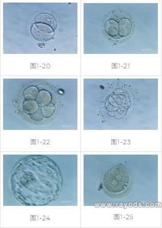 嵩　县52岁第三代试管活检成功率_试管婴儿胚胎移植具体过程及方式
