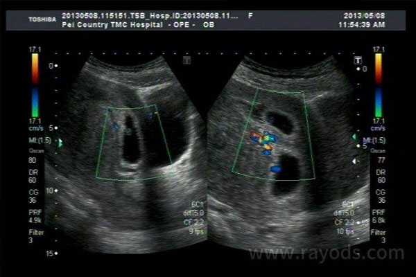 高台县代母移植流程_提高南宁三代试管婴儿胚胎成功率该怎么做？