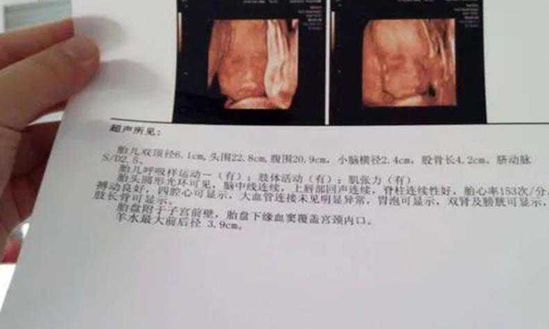 武汉医院捐卵什么时候给你钱 武汉协和医院做试管婴儿成功率高吗 ‘双顶径和