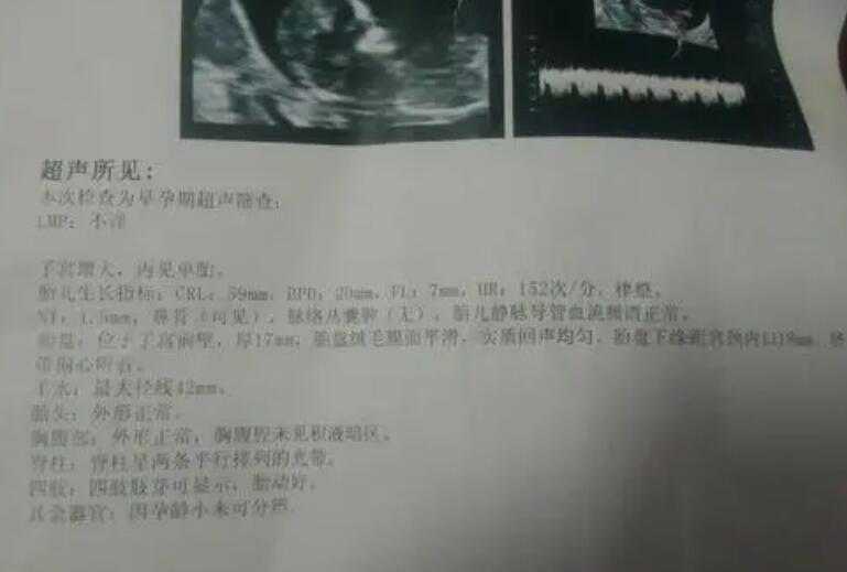 武汉助孕是什么 武汉同济医院三代试管婴儿费用明细 ‘早期彩超怎么看男女’